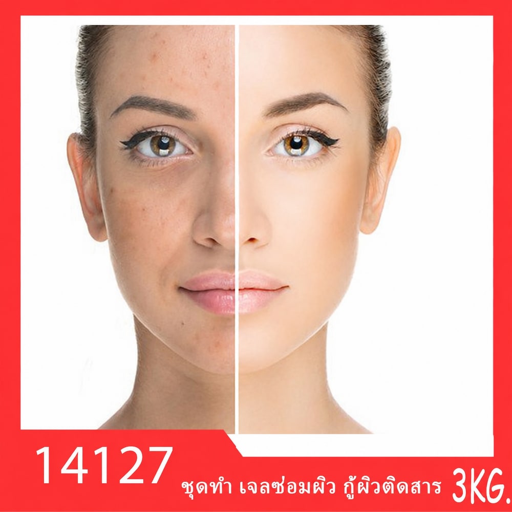 ชุดทำ เจลซ่อมผิว กู้ผิวติดสาร-3kg