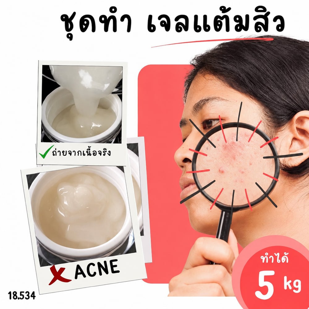 18534 ชุดทำ แอคเน่สปอตเจล เจลแต้มสิว-5kg