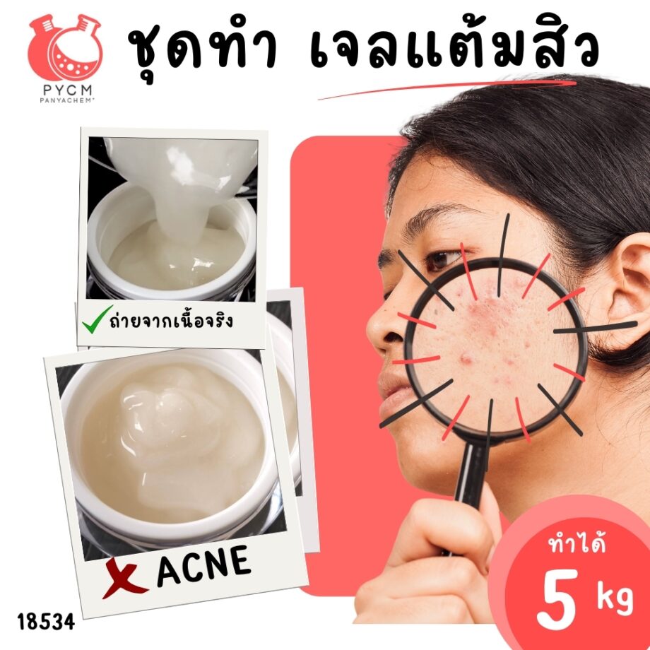 18534 ชุดทำ แอคเน่สปอตเจล เจลแต้มสิว-5kg